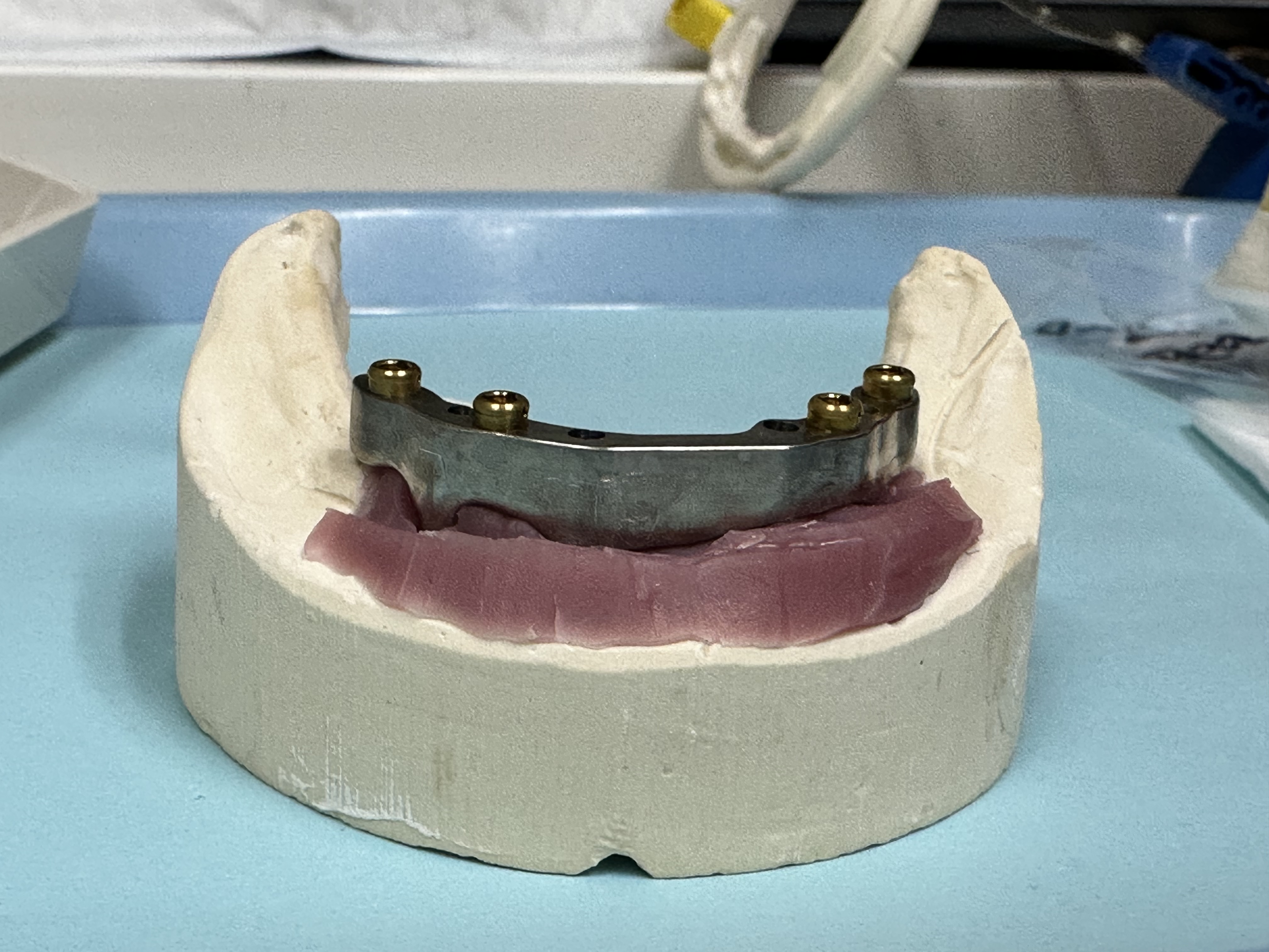 Implant bar on model